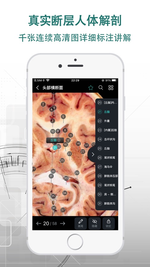 掌上3D解剖app